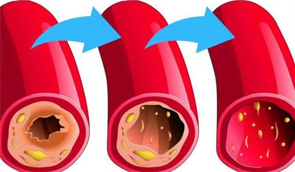 Monascus extract Lower blood fat