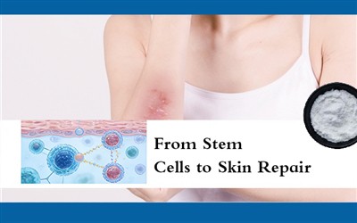 От стволови клетки до възстановяване на кожата
